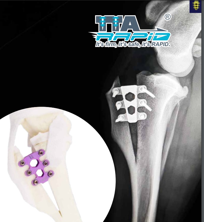 Operace ruptury zkříženého vazu metodou TTA Rapid